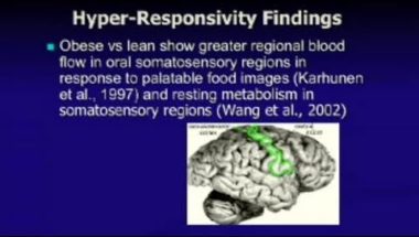 Food and Addiction: Obesity and the Neural Plasticity Reward Circuit