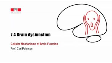 Cellular Mechanisms of Brain Function: Brain dysfunction