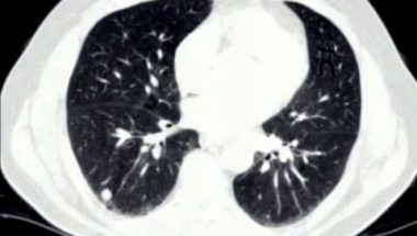 Steven Novella - The Neuroscience of Skepticism