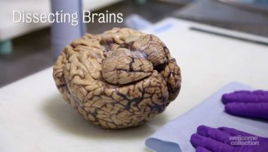 Dissecting Brains