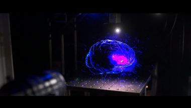 New Insight Into Pain Sensation