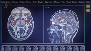 What are the effects of porn on the brain