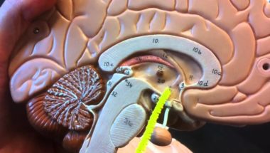 Brain anatomy