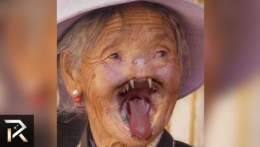 10 Strange Psychological Disorders People Actually Have