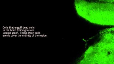 Brain guardians remove dying neurons