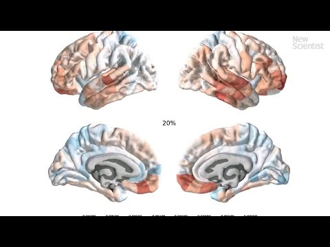 Teenage brain upgrades revealed - The Mind Voyager