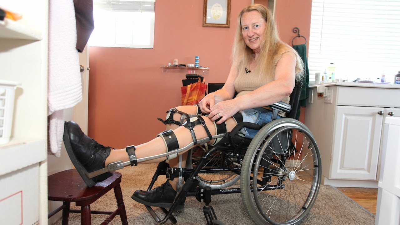 Woman Wants To Be Permanently Paralysed: Body Integrity Identity ...