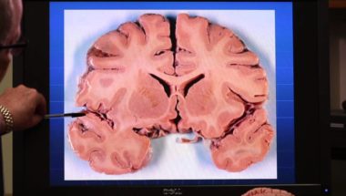 Understanding Gray Matter and White Matter