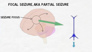 2-Minute Neuroscience: Epilepsy