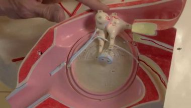 Neuroanatomy Video Lab - Brain Dissections: Auditory System