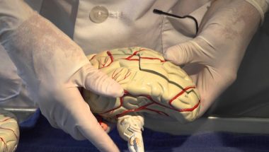 Neuroanatomy Video Lab - Brain Dissections: Cerebral Circulation