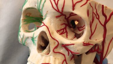 Neuroanatomy Video Lab - Brain Dissections: Control of the Pupil