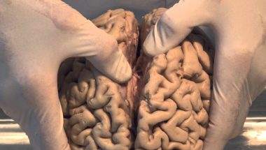 Neuroanatomy Video Lab - Brain Dissections: Introduction