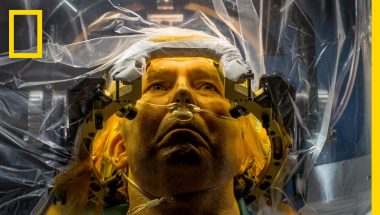 Treating Parkinson’s Disease: Brain Surgery and the Placebo Effect