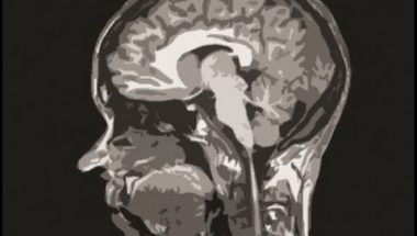 Sarah-Jayne Blakemore: The teenage brain