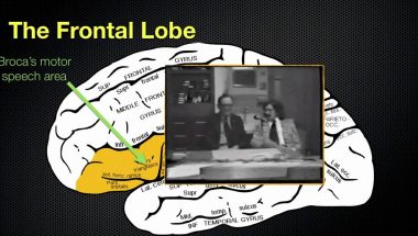 The Anatomy and Functions of the Frontal Lobe