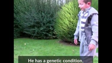Boy with a genetic disease has had almost all his skin replaced