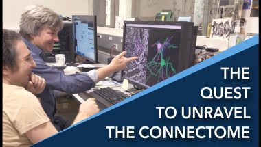 The Quest to Unravel the Connectome